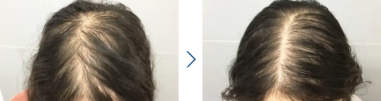 女性 / 50代