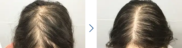 女性 / 50代